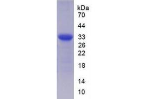 SDS-PAGE analysis of Human ST14 Protein. (APLP2 蛋白)