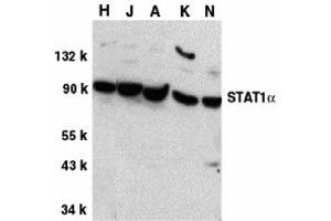 Western Blotting (WB) image for anti-Signal Transducer and Activator of Transcription 1, 91kDa (STAT1) (C-Term) antibody (ABIN1030701) (STAT1 抗体  (C-Term))