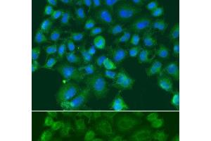 Immunofluorescence analysis of A549 cells using CST1 Polyclonal Antibody (CST1 抗体)