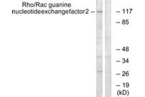 Western blot analysis of extracts from NIH-3T3 cells, using Rho/Rac Guanine Nucleotide Exchange Factor 2 (Ab-885) Antibody. (ARHGEF2 抗体  (AA 851-900))