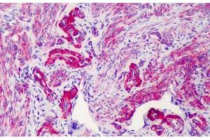 Human Uterus: Formalin-Fixed, Paraffin-Embedded (FFPE) (SLC5A3 抗体  (AA 221-270))