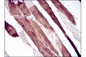 Immunohistochemical analysis of paraffin-embedded muscle tissues using VIL1 mouse mAb with DAB staining. (Villin 1 抗体  (AA 1-209))