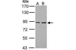 WB Image Sample (30 ug of whole cell lysate) A: 293T B: A431 7. (Prothrombin 抗体  (N-Term))