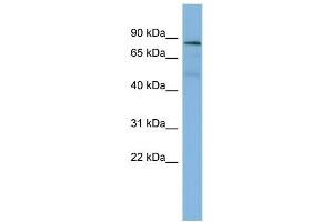 WB Suggested Anti-PTPN12  Antibody Titration: 0. (PTPN12 抗体  (Middle Region))