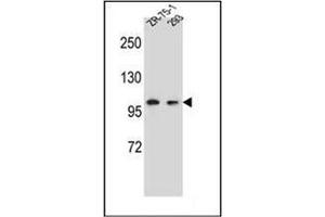 Western blot analysis of GRIP2 Antibody (Center) in ZR-75-1,293 cell line lysates (35ug/lane). (GRIP2 抗体  (Middle Region))