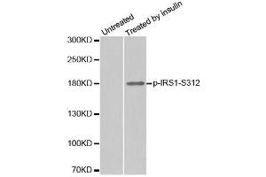 Western blot analysis of extract from 293 cells, using phospho-IRS1-S312 antibody (ABIN2987536). (IRS1 抗体  (pSer312))