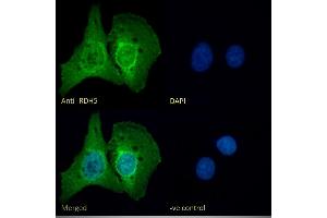 (ABIN571175) Immunofluorescence analysis of paraformaldehyde fixed U2OS cells, permeabilized with 0. (RDH5 抗体  (AA 19-31))