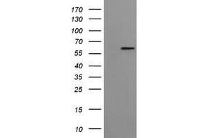 Western Blotting (WB) image for anti-Formiminotransferase Cyclodeaminase (FTCD) antibody (ABIN1496380) (FTCD 抗体)