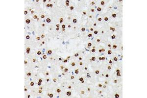 Immunohistochemistry of paraffin-embedded rat liver using HNRNPD antibody (ABIN7267632) at dilution of 1:100 (40x lens). (HNRNPD/AUF1 抗体  (AA 1-306))