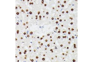 Immunohistochemistry of paraffin-embedded rat liver using HNRNPD antibody (ABIN7267632) at dilution of 1:100 (40x lens). (HNRNPD/AUF1 抗体  (AA 1-306))