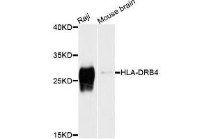 Western blot analysis of extracts of Raji and mouse brain cells, using HLA-DRB4 antibody. (HLA-DRB4 抗体)