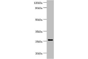 Western blot All lanes: Tumor necrosis factor ligand superfamily member 13 antibody at 10 μg/mL + Hela whole cell lysate Secondary Goat polyclonal to rabbit IgG at 1/10000 dilution Predicted band size: 28, 26, 25, 37, 23 kDa Observed band size: 28 kDa (TNFSF13 抗体  (AA 105-247))