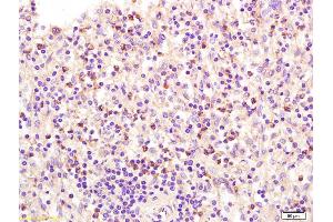 Formalin-fixed and paraffin embedded human spleen labeled with Anti ADCY6 Polyclonal Antibody, Unconjugated (ABIN751198) at 1:200 followed by conjugation to the secondary antibody and DAB staining (ADCY6 抗体  (AA 760-819))