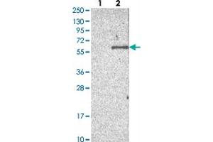 Western blot analysis of Lane 1: Negative control (vector only transfected HEK293T lysate), Lane 2: Over-expression Lysate (Co-expressed with a C-terminal myc-DDK tag (~3. (ACTR6 抗体)