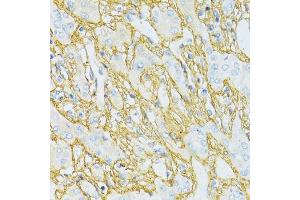 Immunohistochemistry (Paraffin-embedded Sections) (IHC (p)) image for anti-Transforming Growth Factor, beta-Induced, 68kDa (TGFBI) (AA 481-683) antibody (ABIN3023373)