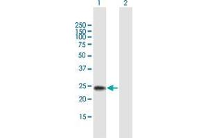 Western Blot analysis of RBPMS2 expression in transfected 293T cell line by RBPMS2 MaxPab polyclonal antibody. (RBPMS2 抗体  (AA 1-209))