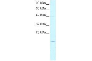 WB Suggested Anti-PFDN1 Antibody Titration:  5. (PFDN1 抗体  (N-Term))