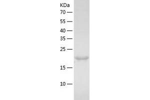 Desert Hedgehog (DHH) (AA 24-198) protein (His tag)
