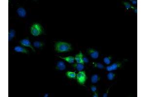 Immunofluorescence (IF) image for anti-Cytochrome P450, Family 2, Subfamily B, Polypeptide 6 (CYP2B6) antibody (ABIN2718982)