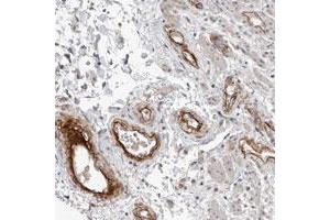 Immunohistochemical staining of human rectum with C1orf216 polyclonal antibody  shows strong positivity in endothelial cells at 1:10-1:20 dilution. (C1ORF216 抗体)