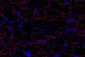 Immunofluorescent analysis of paraformaldehyde-fixed human placenta using GNE (ABIN7074056) at dilution of 1: 600 (GNE 抗体)