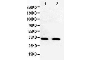 Anti-Cdk5 antibody, Western blotting Lane 1: HELA Cell Lysate Lane 2: JURKAT Cell Lysate (CDK5 抗体  (C-Term))