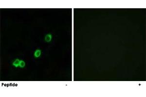Immunofluorescence analysis of MCF-7 cells, using ACOT1 polyclonal antibody . (ACOT1 抗体)
