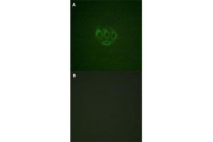 Immunofluorescence staining of methanol-fixed A-549 cells with TNK2 (phospho Y284) polyclonal antibody  without blocking peptide (A) or preincubated with blocking peptide (B) at 1:100-1:200 dilution. (TNK2 抗体  (pTyr284))