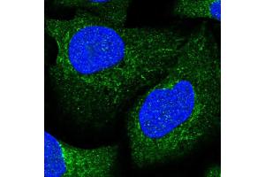 Immunofluorescent staining of human cell line U-2 OS shows localization to cytosol & mitochondria. (Aconitase 1 抗体  (AA 800-889))