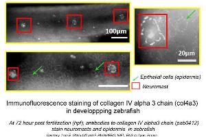 Image no. 1 for anti-Collagen, Type IV, alpha 3 (COL4A3) (C-Term) antibody (ABIN347487)