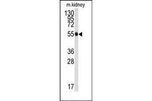 Image no. 1 for anti-Aldehyde Dehydrogenase 9 Family, Member A1 (ALDH9A1) (C-Term) antibody (ABIN360205) (ALDH9A1 抗体  (C-Term))