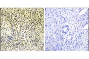 Immunohistochemistry (IHC) image for anti-Spleen tyrosine Kinase (SYK) (AA 289-338) antibody (ABIN2888703) (SYK 抗体  (AA 289-338))