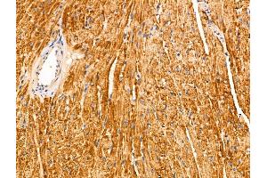 ABIN6265607 and ABIN6266680 at 1/100 staining Mouse heart tissue by IHC-P.