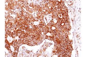 Immunohistochemistry (IHC) image for anti-Heat Shock Protein 90kDa alpha (Cytosolic), Class B Member 1 (HSP90AB1) (Internal Region) antibody (ABIN2855037)