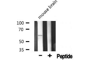 Western blot analysis of Phospho-AKT1(Thr308) expression in Mouse brain lysate (AKT1 抗体  (pThr308))
