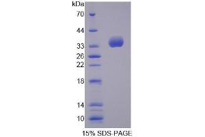 Image no. 1 for Tubulin Folding Cofactor B (TBCB) (AA 1-244) protein (His tag) (ABIN6239644) (TBCB Protein (AA 1-244) (His tag))