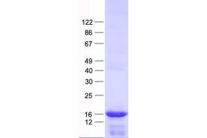 Validation with Western Blot