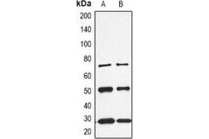 Western blot analysis of CALB1 expression in K562 (A), rat kidney (B) whole cell lysates. (CALB1 抗体  (C-Term))