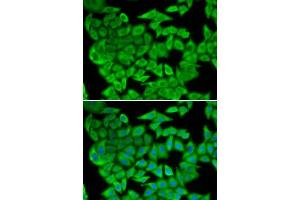 Immunofluorescence analysis of U2OS cells using MDH2 antibody. (MDH2 抗体  (AA 59-338))