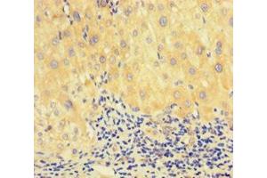 Immunohistochemistry (IHC) image for anti-DNA Repair Protein Homolog 1 (RAD51) (AA 1-228) antibody (ABIN7150287)