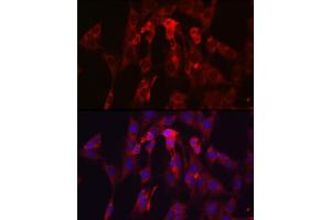 Immunofluorescence analysis of C6 cells using TIMP2 Rabbit pAb (ABIN3022132, ABIN3022133, ABIN1513608, ABIN1514751 and ABIN6218618) at dilution of 1:250 (40x lens). (TIMP2 抗体  (AA 100-200))