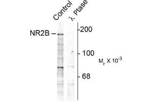 Image no. 1 for anti-Glutamate Receptor, Ionotropic, N-Methyl D-Aspartate 2B (GRIN2B) (pTyr1252) antibody (ABIN372685) (GRIN2B 抗体  (pTyr1252))