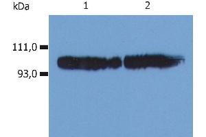Western Blotting (WB) image for anti-Integrin beta 2 (ITGB2) antibody (Biotin) (ABIN94007)