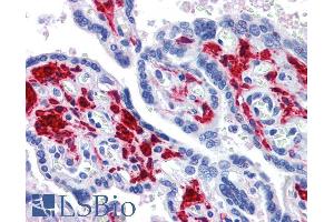 Immunohistochemistry (IHC) image for anti-DEAD (Asp-Glu-Ala-Asp) Box Polypeptide 58 (DDX58) (C-Term) antibody (ABIN6391376)