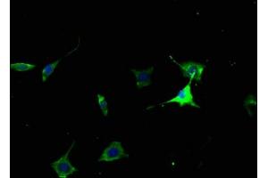 Immunofluorescence staining of SH-SY5Y cells with ABIN7139924 at 1:50, counter-stained with DAPI. (Muscarinic Acetylcholine Receptor M2 抗体  (AA 3-20))