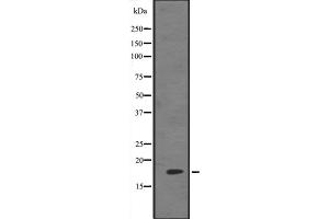Western blot analysis of HES5 expression in 293 cell lysate ,The lane on the left is treated with the antigen-specific peptide. (HES5 抗体  (Internal Region))