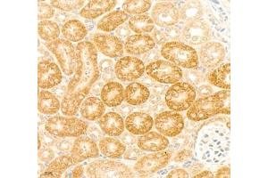 Immunohistochemistry of paraffin embedded mouse kidney using collagen alpha-1 (V) (ABIN7073547) at dilution of 1: 1800 (400x lens)