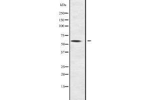Western blot analysis of NOC4L expression in NOC4L transfected 293T cell lysate;,The lane on the left is treated with the antigen-specific peptide. (NOC4L 抗体  (Internal Region))