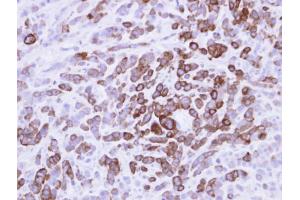 IHC-P Image MX1 Antobody detects MX1 protein at cytosol on MDA-MB-468 xenograft by immunohistochemical analysis. (MX1 抗体  (Center))