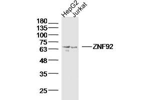 Lane 1: Hepg2 lysates Lane 2: Jurkat lysates probed with ZNF92 Polyclonal Antibody, Unconjugated  at 1:300 dilution and 4˚C overnight incubation. (ZNF92 抗体  (AA 21-120))